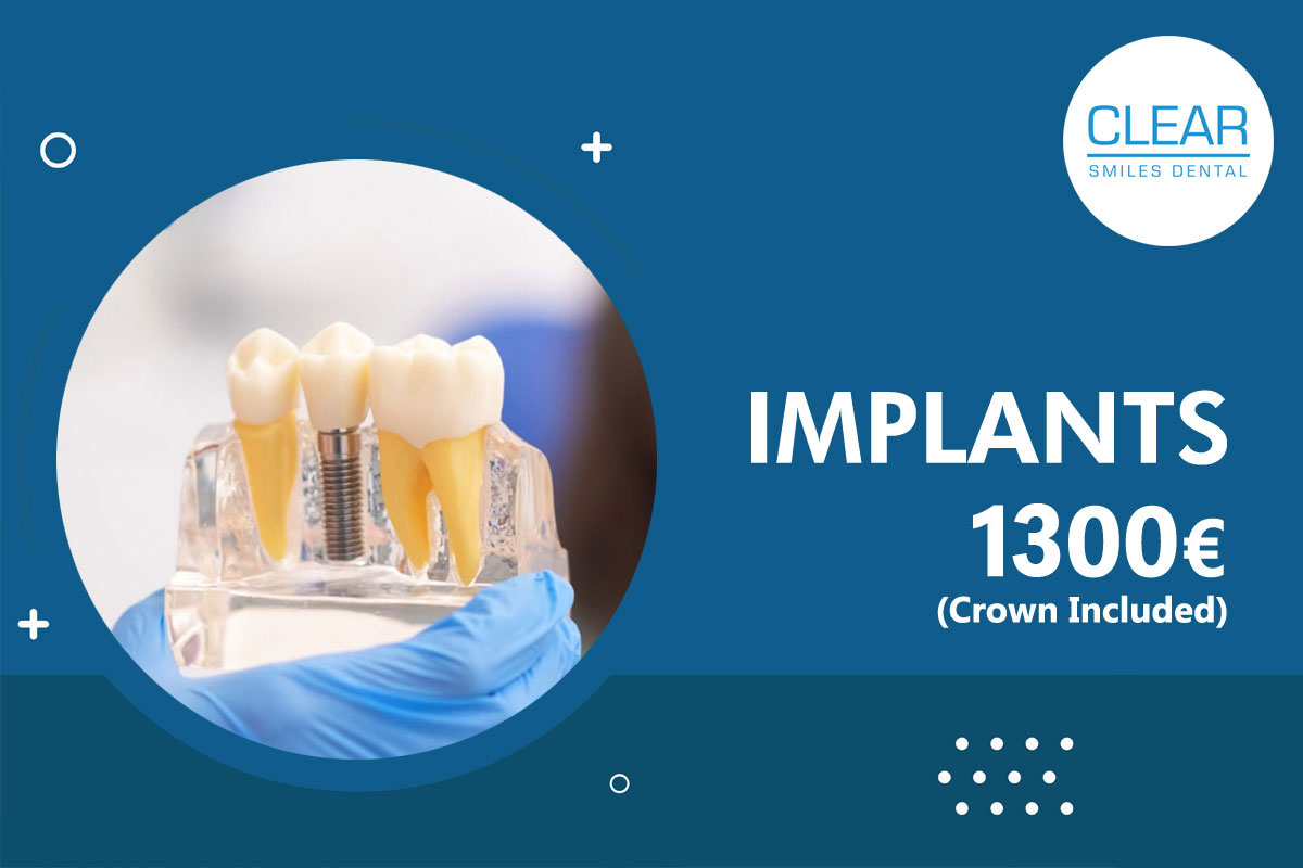 Implants-v55-4