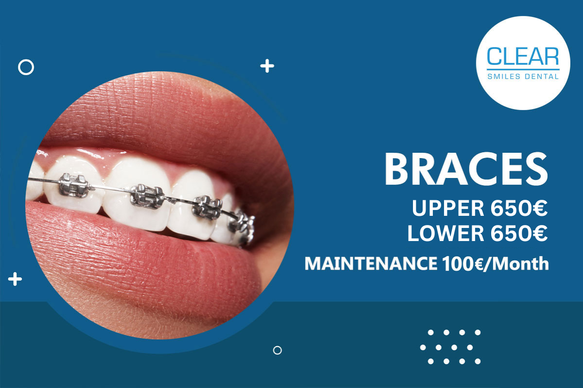 UPPER 650€ LOWER 650€